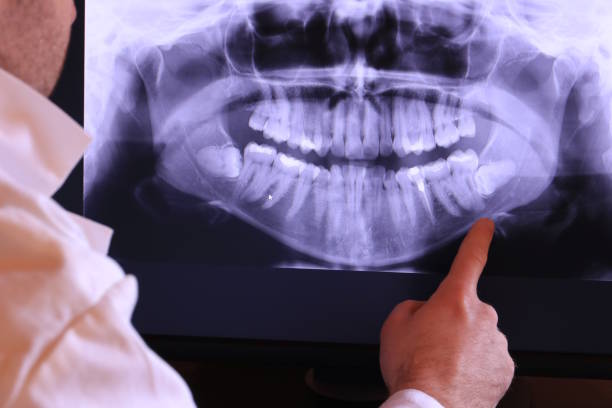 Best Emergency Treatment for Dental Infections or Abscesses in Woodridge, IL