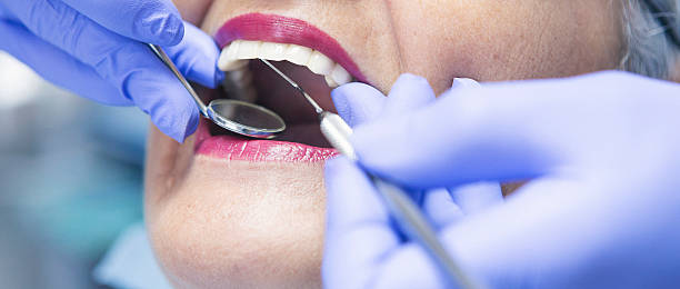 Best Emergency Dental Care for Broken or Chipped Teeth in Woodridge, IL